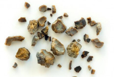 5 Tips Mencegah Batu Ginjal yang Mudah Dilakukan, Salah Satunya Pakai Kacang, Kok Bisa?