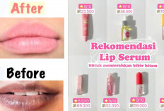 5 Rekomendasi Lip Serum untuk Bibir Gelap, Bikin Lembap, Plumpy & Lembut, Bye-bye Pecah-pecah!