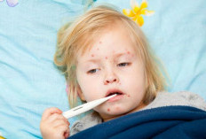 Waspada Campak! Kenali Gejala Awal dan Cara Efektif Mencegahnya, Cek Selengkapnya Disini