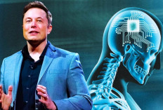 Ngeri, Elon Musk Berhasil Tanam Chip di Otak Manusia, Diklaim Penggunanya Bisa Telepati!