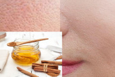 3 Bahan Alami untuk Mengecilkan Pori-Pori, Bikin Kulit Halus, Cerah dan Bebas Komedo, Yuk Cobain Bestie!