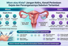 Miom atau Kista? Jangan Keliru, Kenali Perbedaan Gejala dan Penanganannya Sebelum Terlambat
