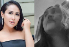 Ratu Meta Diduga Alami KDRT Suaminya, Diinjak hingga Dipukul Pakai Alat Perkakas Mobil