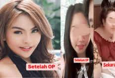 Heboh Foto Dugaan Lisa Mariana Sebelum dan Sesudah Operasi Plastik Selingkuhan Ridwan Kamil