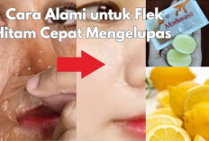 Gak Perlu Perawatan Mahal! ini 6 Cara Agar Flek Hitam di Wajah Cepat Mengelupas, Bikin Kulit Cerah & Sehat 