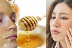 Stop Panik! Begini Cara Agar Flek Hitam Cepat Mengelupas dan Memudar, Dijamin Anti Gagal