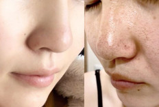 Kulit Mulus ala Seleb! Ini Cara Alami Mengecilkan Pori-Pori & Meratakan Kulit Wajah yang Bikin Glowing