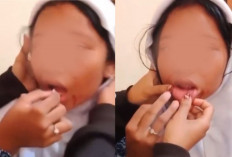 Dinas Pendidikan Klarifikasi Video Viral SMPN 31 Palembang Bukan Bullying, Sudah Diselesaikan Damai