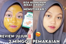 Wow, Masker Bubuk Kunyit Bikin Wajah Glowing Permanen Tanpa Skincare, Bye-Bye Flek Hitam...