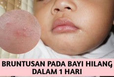 Bunda Jangan Panik, Begini Cara Menghilangkan Bruntusan pada Wajah Bayi yang Terkena ASI