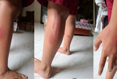Oknum Guru di Lubuklinggau Diduga Aniaya Siswa Sekolah Dasar karena Tak Hafal Perkalian