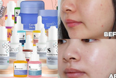 7 Rekomendasi Serum SOMETHINC Terbaik, Solusi Ampuh untuk Bekas Jerawat dan Kulit Kusam