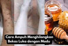 3 Cara Ampuh Menghilangkan Bekas Luka dengan Madu Bikin Kulit Mulus & Mencerahkan, Begini Cara Meraciknya!