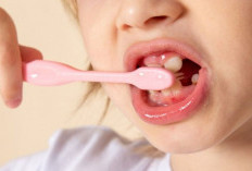 Tips Merawat Gigi Anak agar Bebas dari Karies, Simpel tapi Efektif!