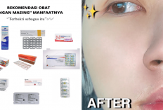 7 Obat Pengecil Pori-Pori di Apotik Paling Manjur Dengan Harga Murah di Bawah 50K, Cobain Bestie!