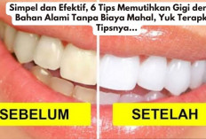 Simpel dan Efektif, 6 Tips Memutihkan Gigi dengan Bahan Alami Tanpa Biaya Mahal, Yuk Terapkan Tipsnya...