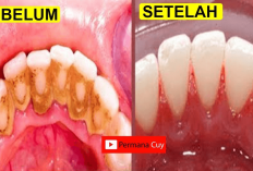 11 Tips Cara Alami Menghilangkan Plak Gigi Secara Permanen dari dr. Zaidul Akbar, Sekali Pakai Jadi Bersih!