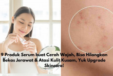 9 Produk Serum buat Mencerahkan Wajah, Bisa Hilangkan Bekas Jerawat & Atasi Kulit Kusam, Yuk Upgrade Skincare!