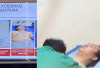 RSCM Beberkan Kondisi Andrie Yunus Pasca Serangan Air Keras, Ini Dampaknya